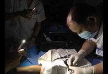 醫生臺風中做手術突停電 自制“手機無影燈”救險