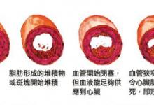 它是三高血管堵塞的根源