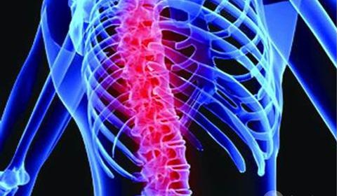 人體中關于脊柱方面的疾病有哪些